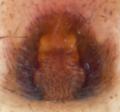 Epigyne des Weibchens