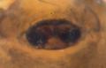 Epigyne